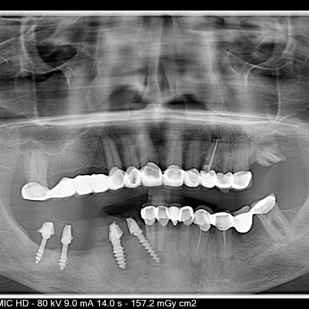 Dentistry On The Square, Pain Free Dentist Glasgow - Dentistry On The Square, Pain Free Dentist Smile rescue