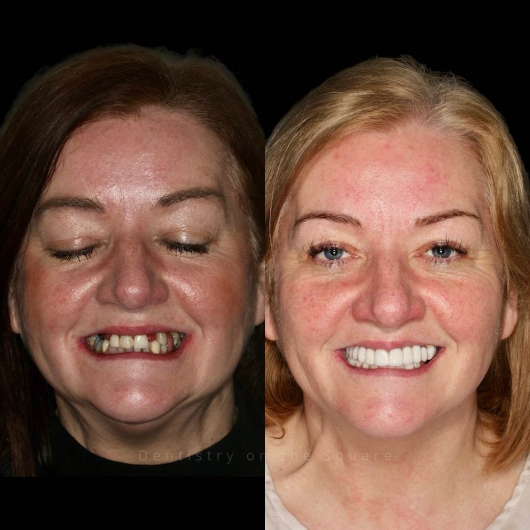 Dentistry On The Square, Pain Free Dentist Glasgow - Dentistry On The Square, Pain Free Dentist Smiles We’ve Made