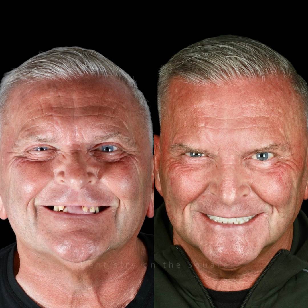 Dentistry On The Square, Pain Free Dentist Glasgow - Dentistry On The Square, Pain Free Dentist Smiles We’ve Made