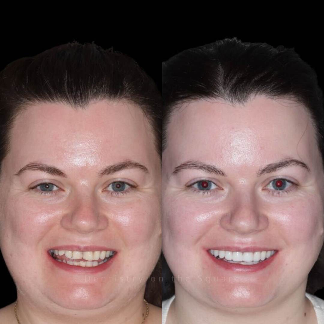 Dentistry On The Square, Pain Free Dentist Glasgow - Dentistry On The Square, Pain Free Dentist Smiles We’ve Made