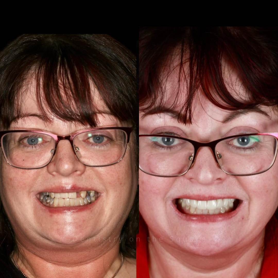 Dentistry On The Square, Pain Free Dentist Glasgow - Dentistry On The Square, Pain Free Dentist Smiles We’ve Made