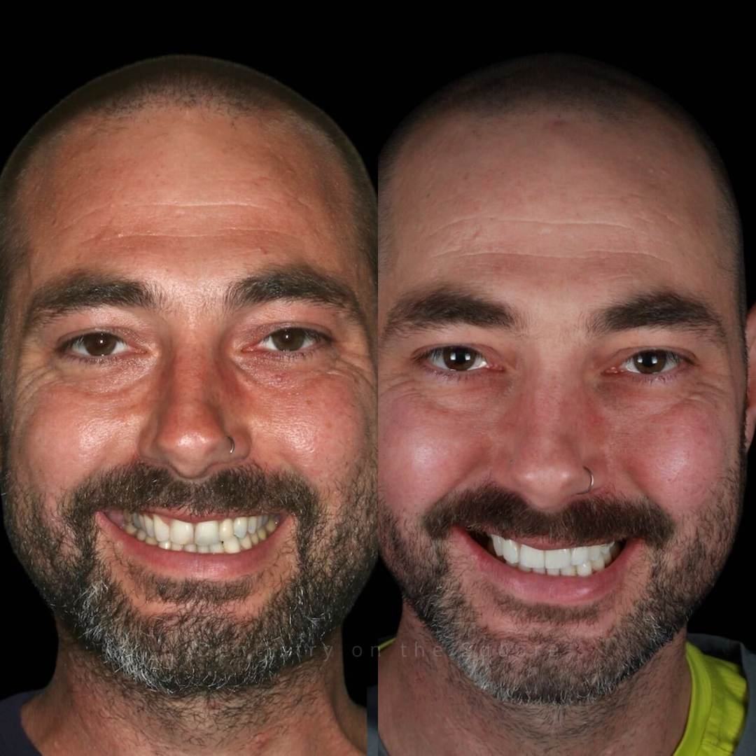 Dentistry On The Square, Pain Free Dentist Glasgow - Dentistry On The Square, Pain Free Dentist Smiles We’ve Made