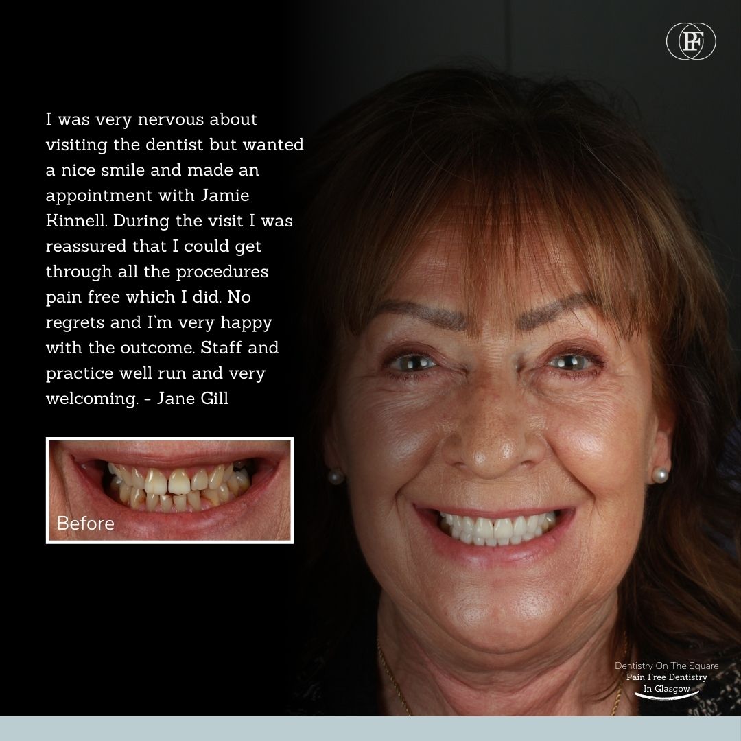 Jane Gill - Jamie Kinnell smile makeover (1)