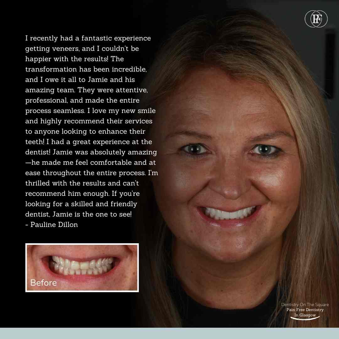Pauline Dillon - Jamie Kinnell smile makeover (1)